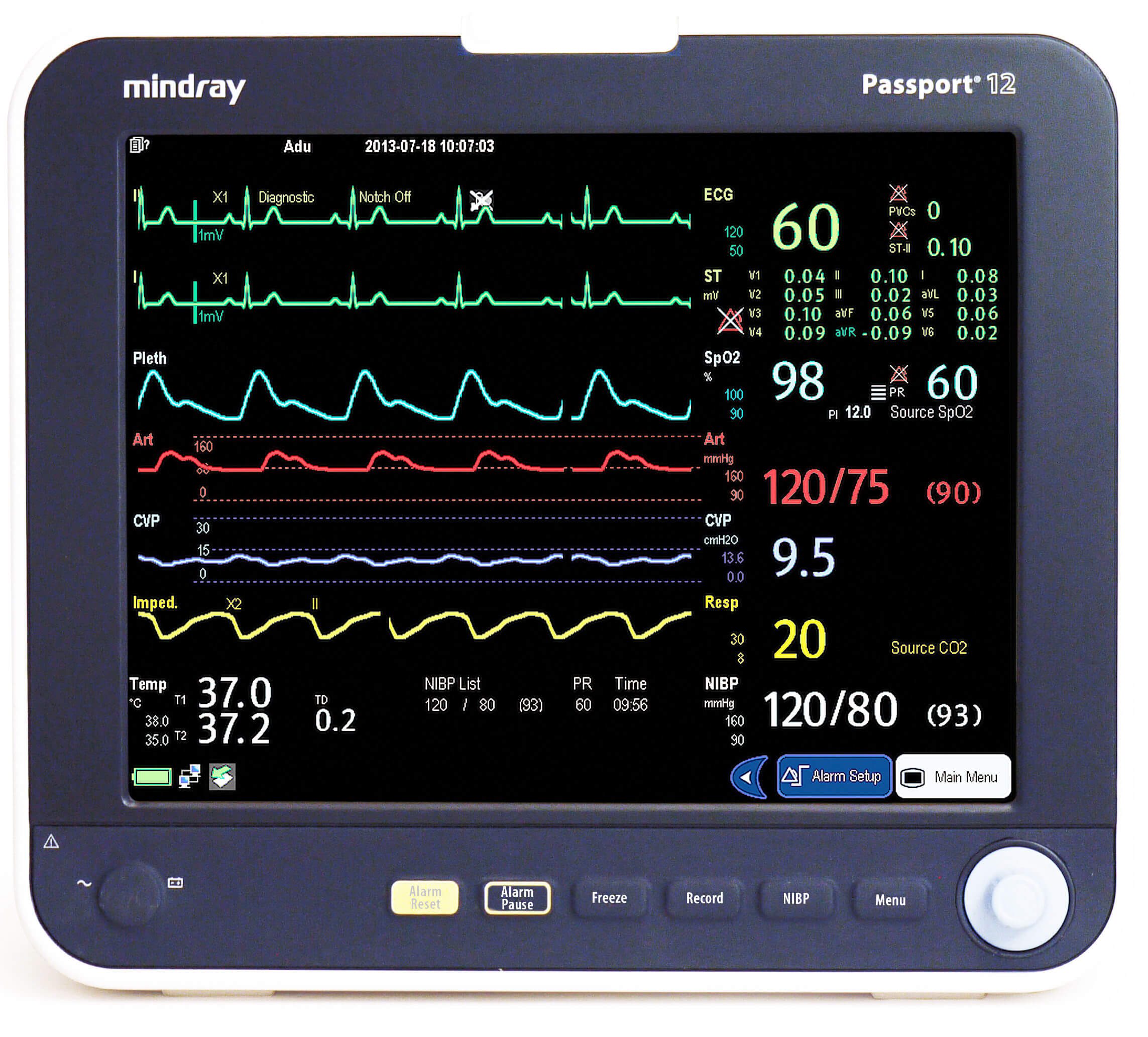 Mindray Passport 12 Patient Monitor