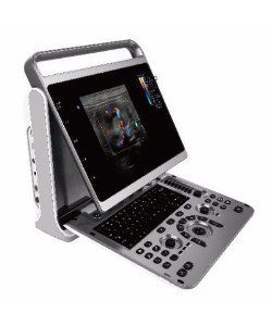 Chison EBIT 50 Ultrasound with 18mhz Probe