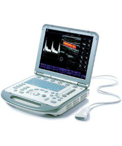 Mindray M5 Ultrasound