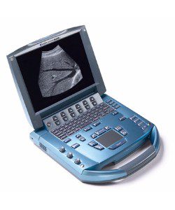 Sonosite Micromaxx Ultrasound
