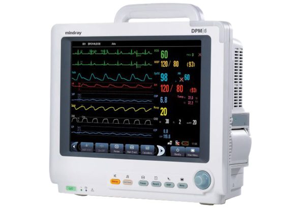 Anesthesia Monitor