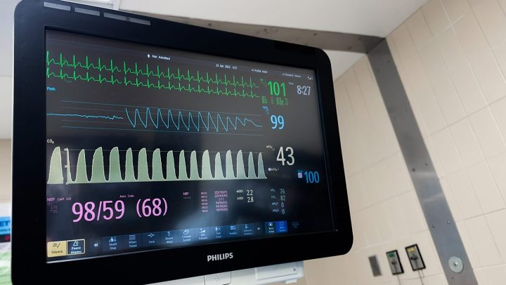 Patient Monitor