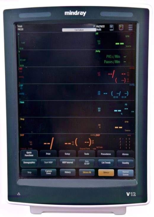 Mindray V12 Monitor