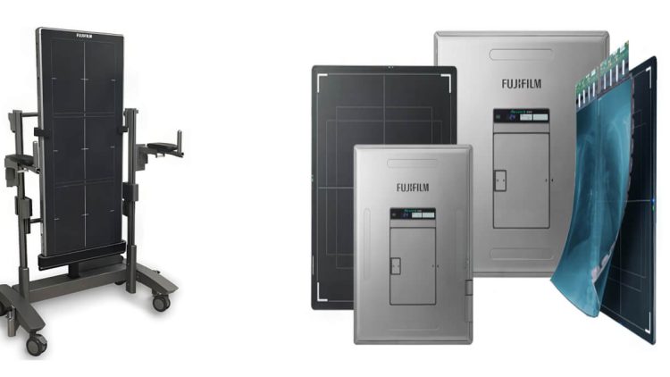 X-Ray Digital Detectors at Auxo Medical