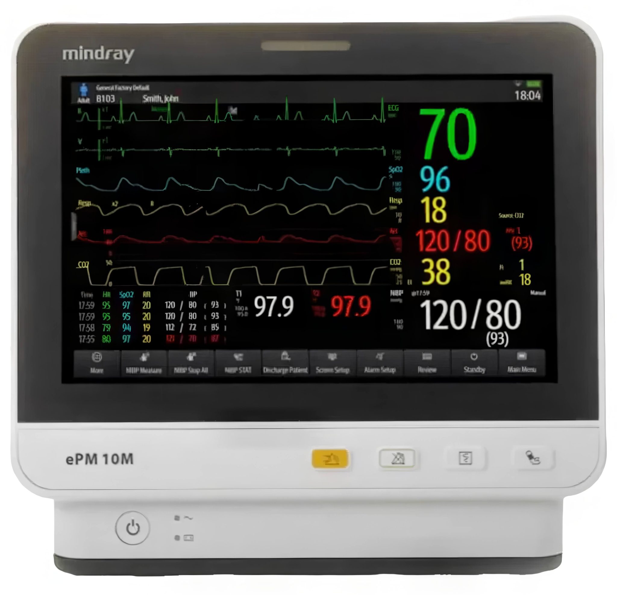 Mindray Patient Monitors Available at Auxo Medical | Auxo Medical