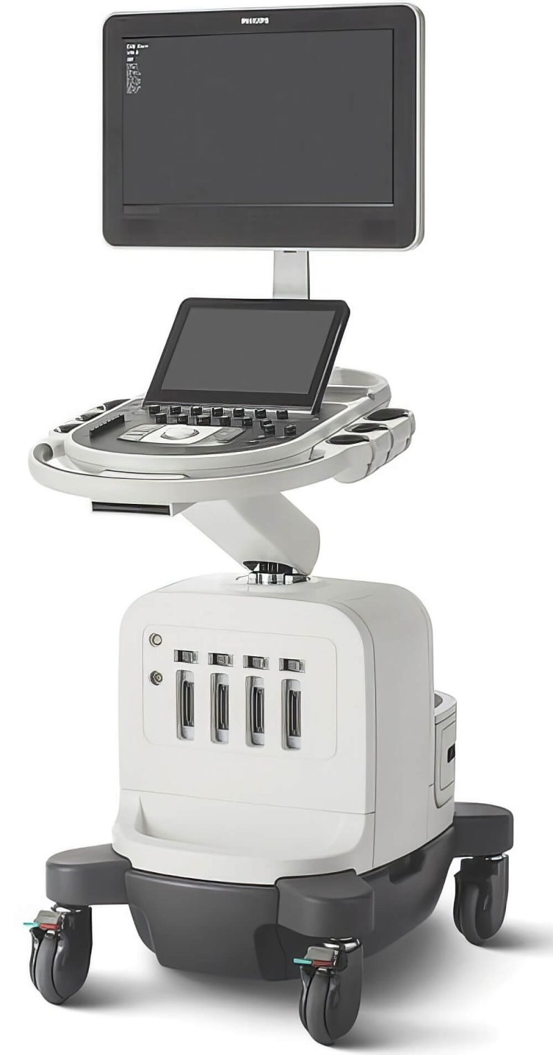 Philips 70 G Ultrasound Machine
