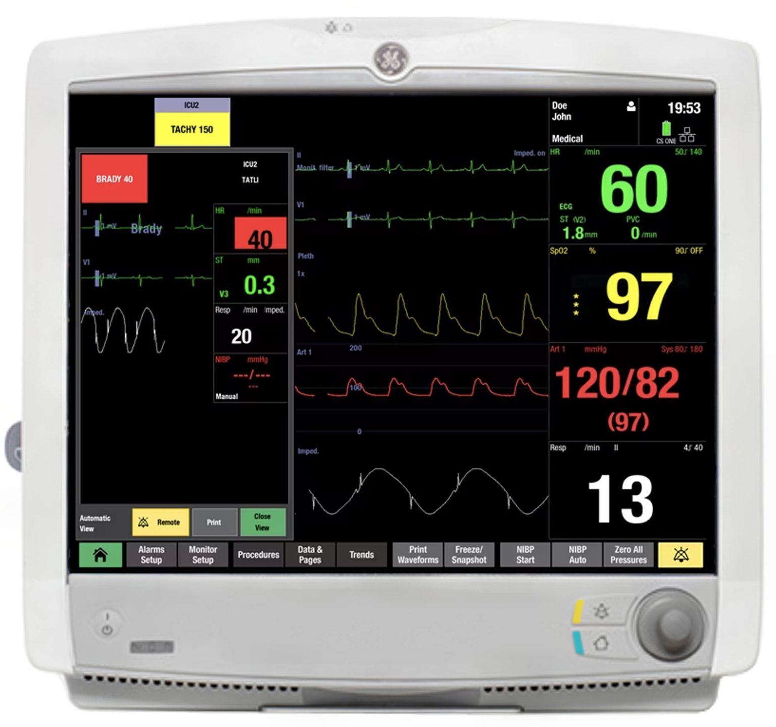 GE Carescape B650 Patient Monitor with 5 Agent Gas Analysis | Auxo Medical