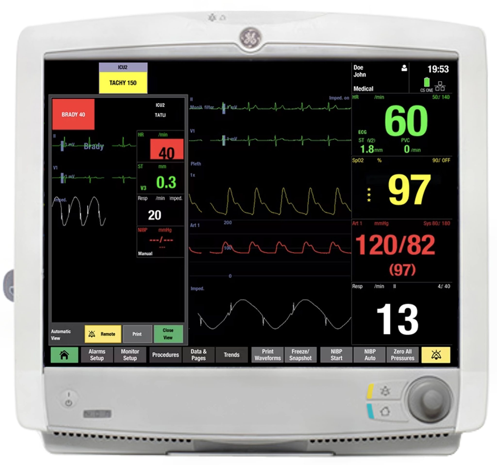 GE Carescape B650 Patient Monitor With 5 Agent Gas Analysis | Auxo Medical