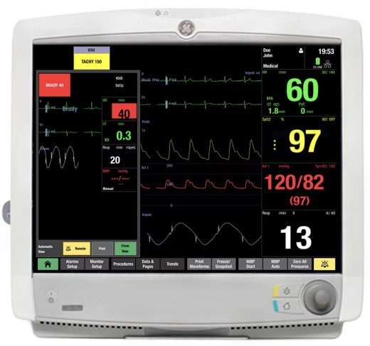 GE Carescape B650 Patient Monitor