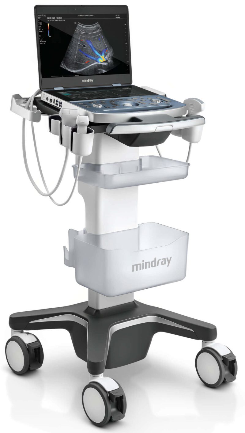 Mindray MX7 Ultrasound Cart Only
