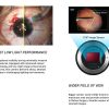 ESC Surgical Microscope camera with Recorder - Features 2