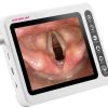 Infinium® ClearVue™ VLXL video laryngoscope